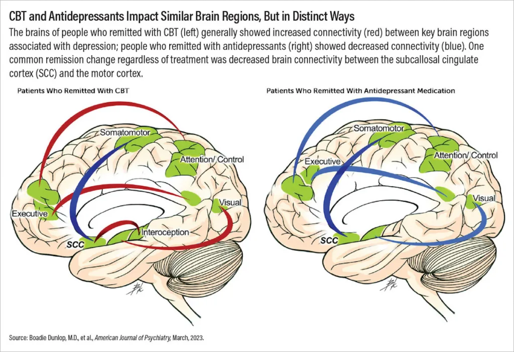 two brain drawings with markings in green for CBT and antidepressants impact
