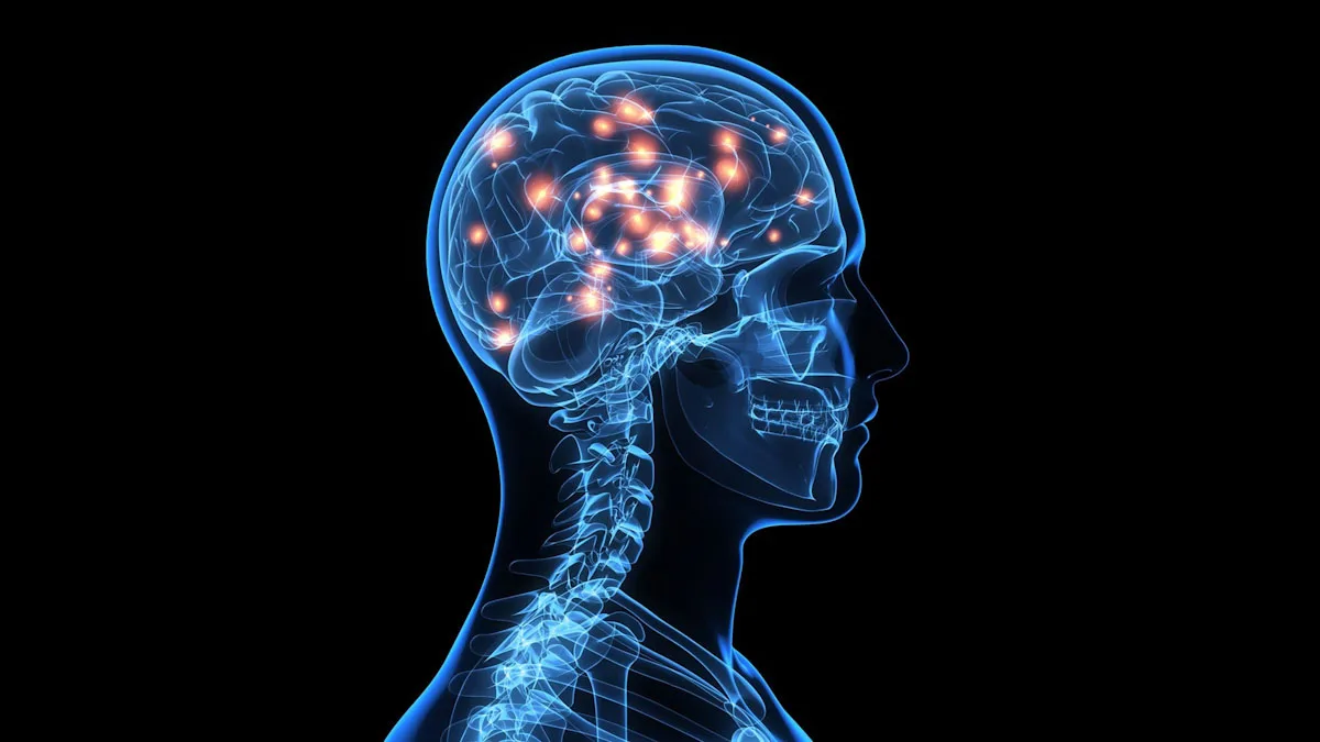 Alzheimer's-disease brain scan with neurons